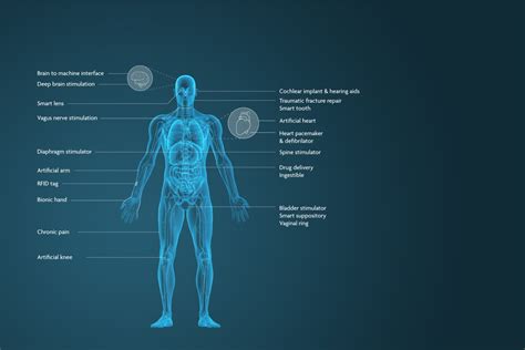  Elastine: De Toekomst van Flexibiliteit in Medische Implantaten?